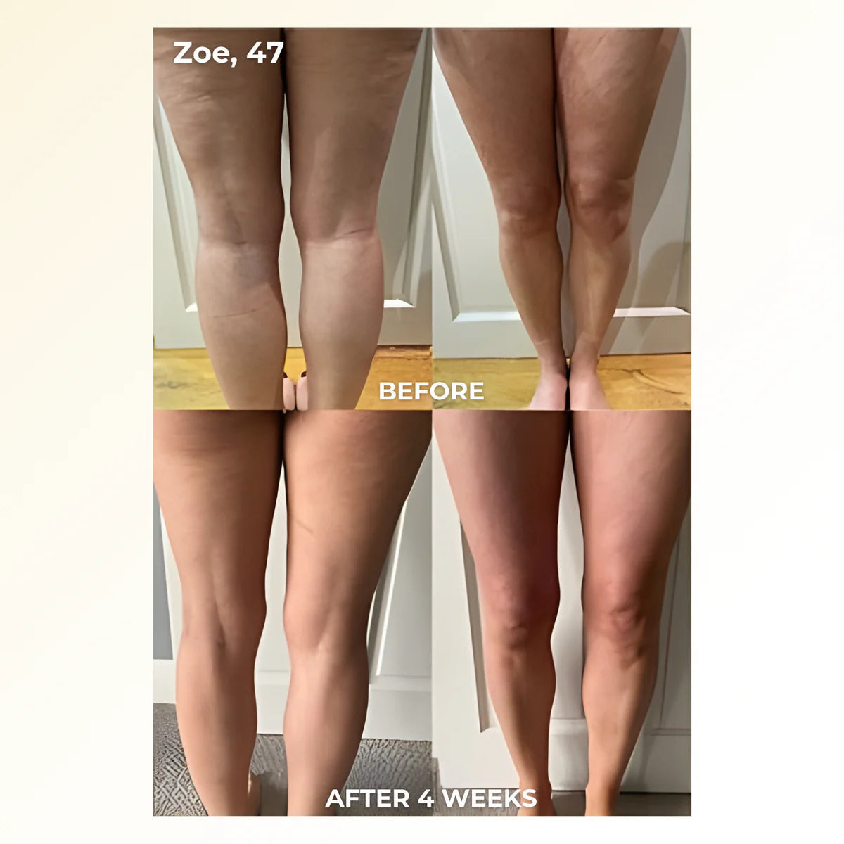 PrimeSculpt 4-in-1 Fascia Full-Body Sculpting Blade